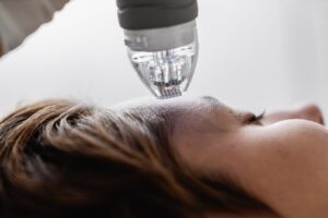 Microneedling in Chicago at PureMargins Aesthetic Clinic
