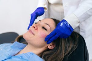 PRF Facial at PureMargins Aesthetic Clinic