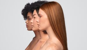 PRF Hair Therapy at PureMargins Aesthetic Clinic in Chicago
